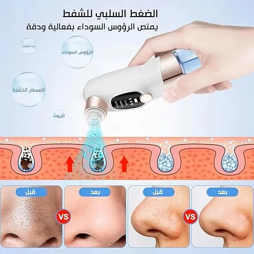 جهاز ازالة الرؤوس السوداء بالمياه 6