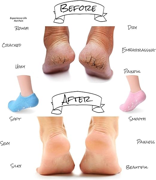 شراب السيليكون طبى لترطيب ونعومة القدمين 2
