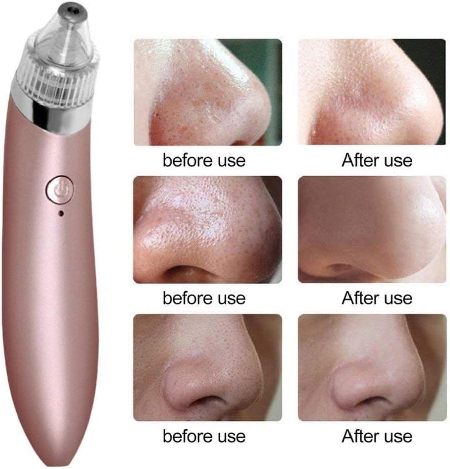 عرض تنضيف البشرة + الهدية